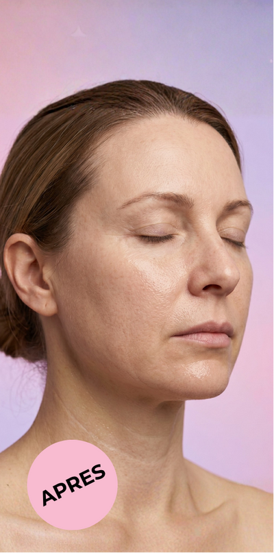 Sophie, 38 ans - After
