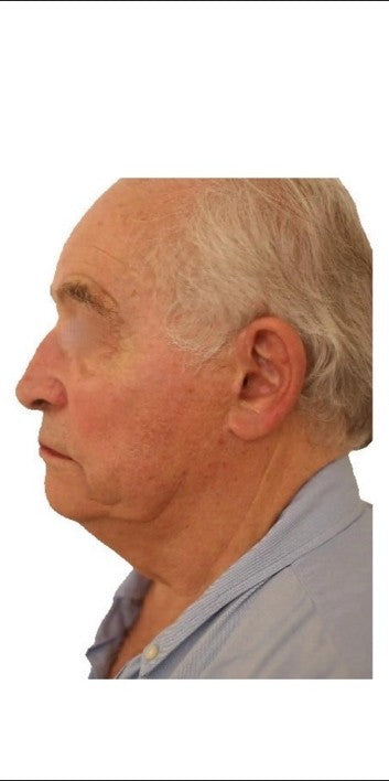 Claude, 64 ans - Before