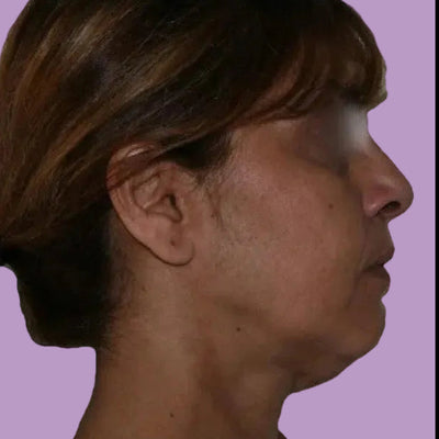 Florence, 31 ans - Before