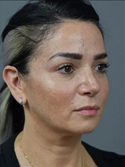 Amélie, 34 ans - After
