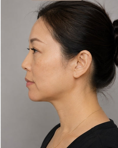 May, 34 ans - After