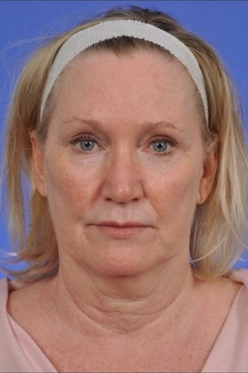 Régine, 57 ans - Before