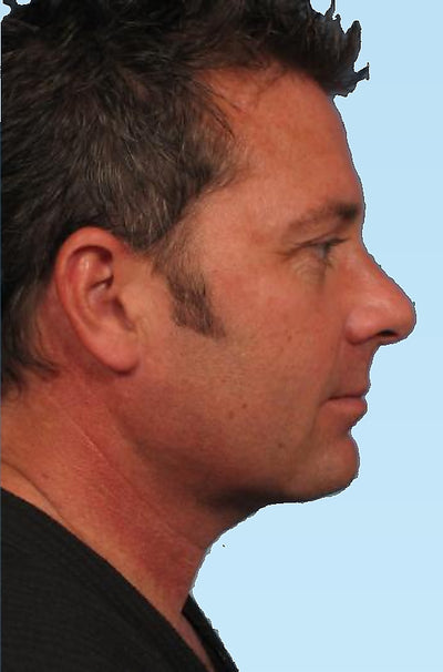 John, 35 ans - After