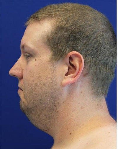 Cyril, 31 ans - Before