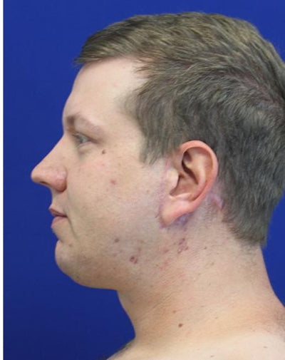 Cyril, 31 ans - After