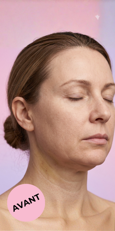 Sophie, 38 ans - Before