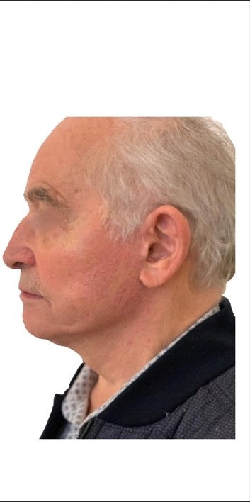 Claude, 64 ans - After