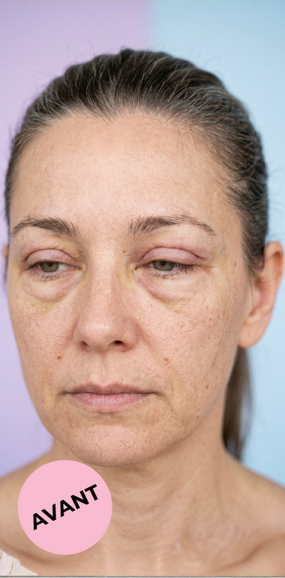 Sandrine, 42 ans - Before