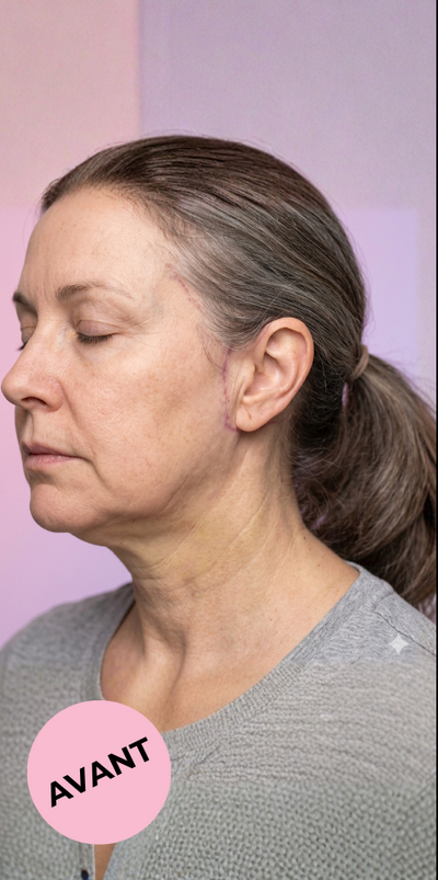 Catherine, 51 ans - Before