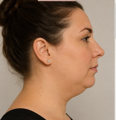 Alicia, 30 ans - Before