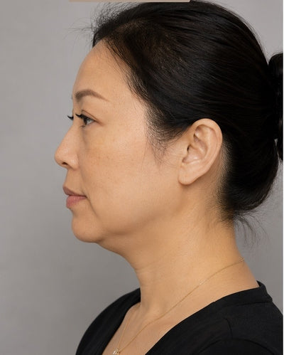 May, 34 ans - Before