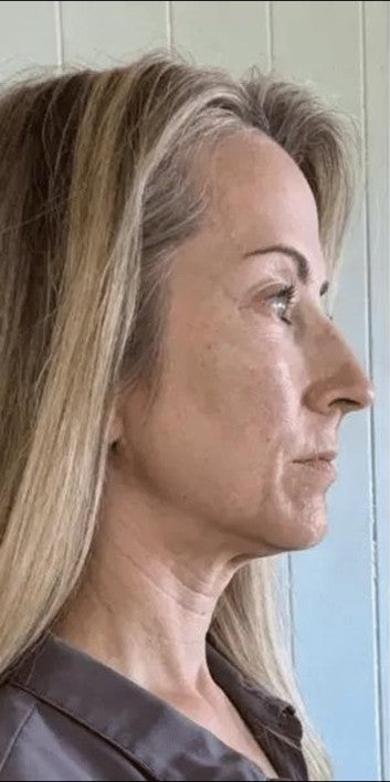 Carole, 53 ans - Before