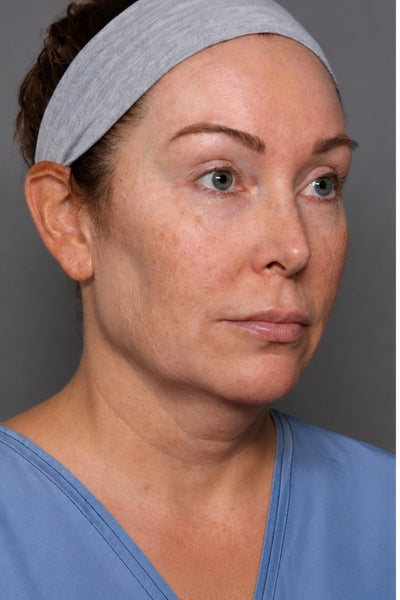 Katia, 54 ans - Before